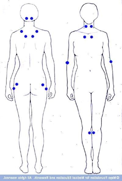Fibromyalgi. Psykiske helseproblemer. Fibromyalgi. Psykiske helseproblemer.