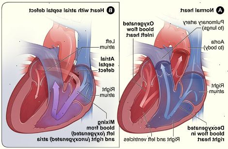 Forberedelser til din avtale. Pulmonal hypertensjon. Forberedelser til din avtale. Pulmonal hypertensjon.