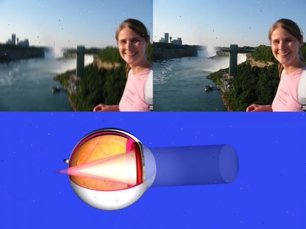 Skjeve hornhinner. Nærsynthet (nærsynthet). Skjeve hornhinner. Nærsynthet (nærsynthet).