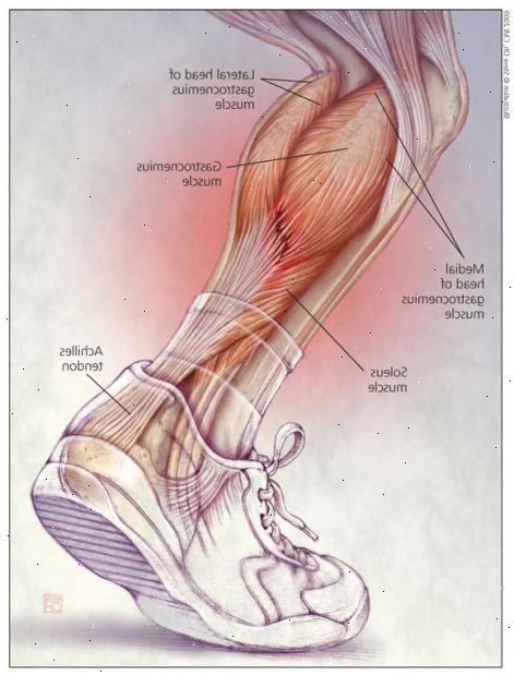 Achilles senebetennelse. Magnetic resonance imaging (MRI). Achilles senebetennelse. Magnetic resonance imaging (MRI).