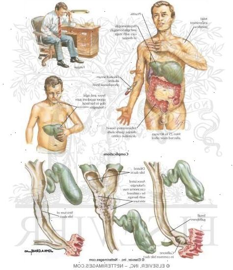 Primær skleroserende kolangitt. Inflammatorisk tarmsykdom. Primær skleroserende kolangitt. Inflammatorisk tarmsykdom.