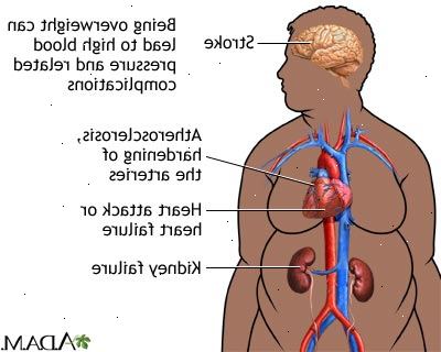 Forberedelser til din avtale. Very-low-density lipoprotein (VLDL). Forberedelser til din avtale. Very-low-density lipoprotein (VLDL).