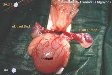 Retinerte testikkel (cryptorchidism). Testikkelkreft. Retinerte testikkel (cryptorchidism). Testikkelkreft.
