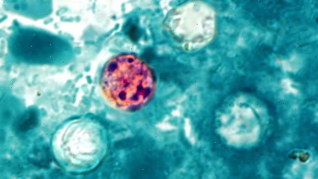 Cyclospora infeksjon. Hva du kan forvente fra legen din. Cyclospora infeksjon. Hva du kan forvente fra legen din.