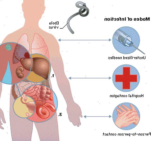 Ebola-viruset og Marburg-viruset. Overføring fra dyr til mennesker. Ebola-viruset og Marburg-viruset. Overføring fra dyr til mennesker.